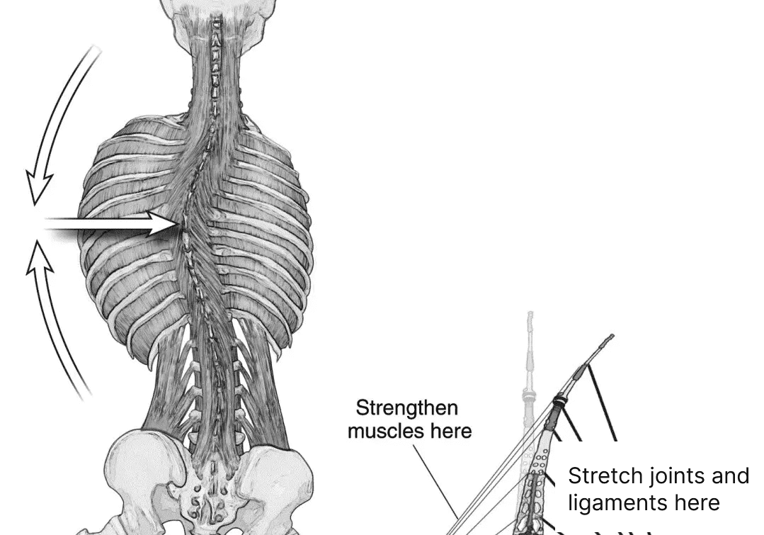 Spine anatomy diagram illustrating stretch and strengthening